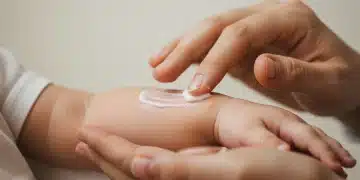 Gentle hand applying cream to baby's arm with mild eczema